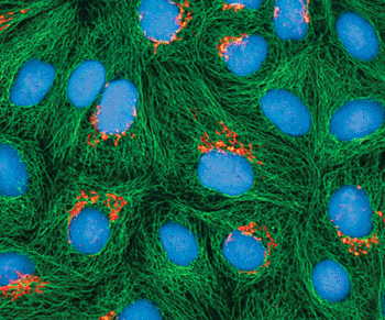 Image: Multiphoton fluorescence image of cultured HeLa cells with a fluorescent protein targeted to the Golgi apparatus (orange), microtubules (green) and counterstained for DNA (cyan). NIH-funded work at the National Center for Microscopy and Imaging Research (Photo courtesy of Tom Deerinck, NIH).